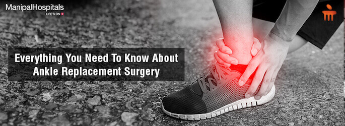 Ankle Replacement Surgery