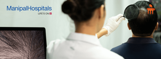 hair fall treatment in bangalore