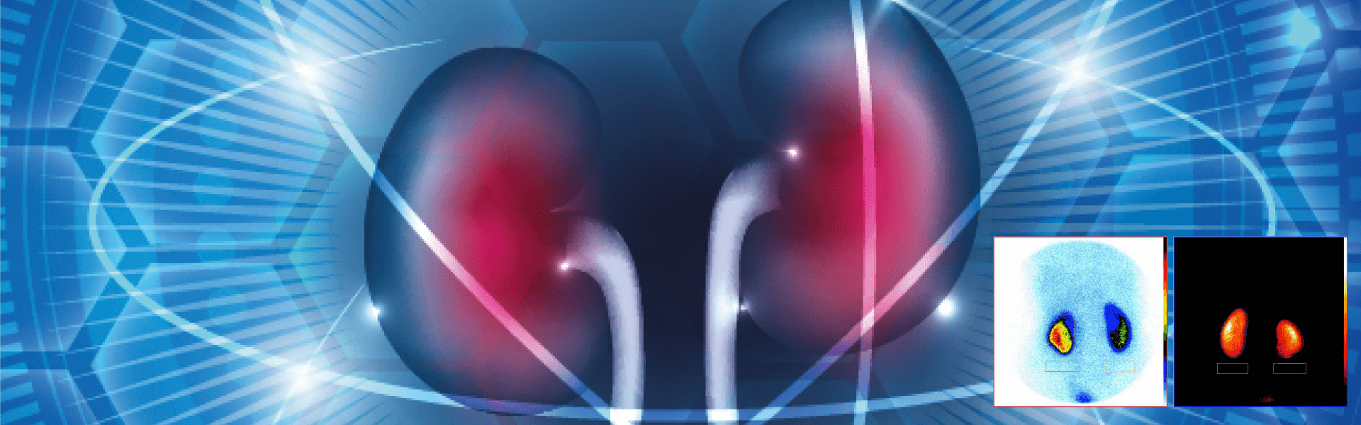 Renal DMSA Scan | Manipal Hospitals India